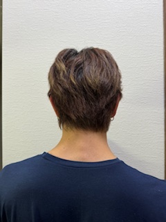 写真:Before